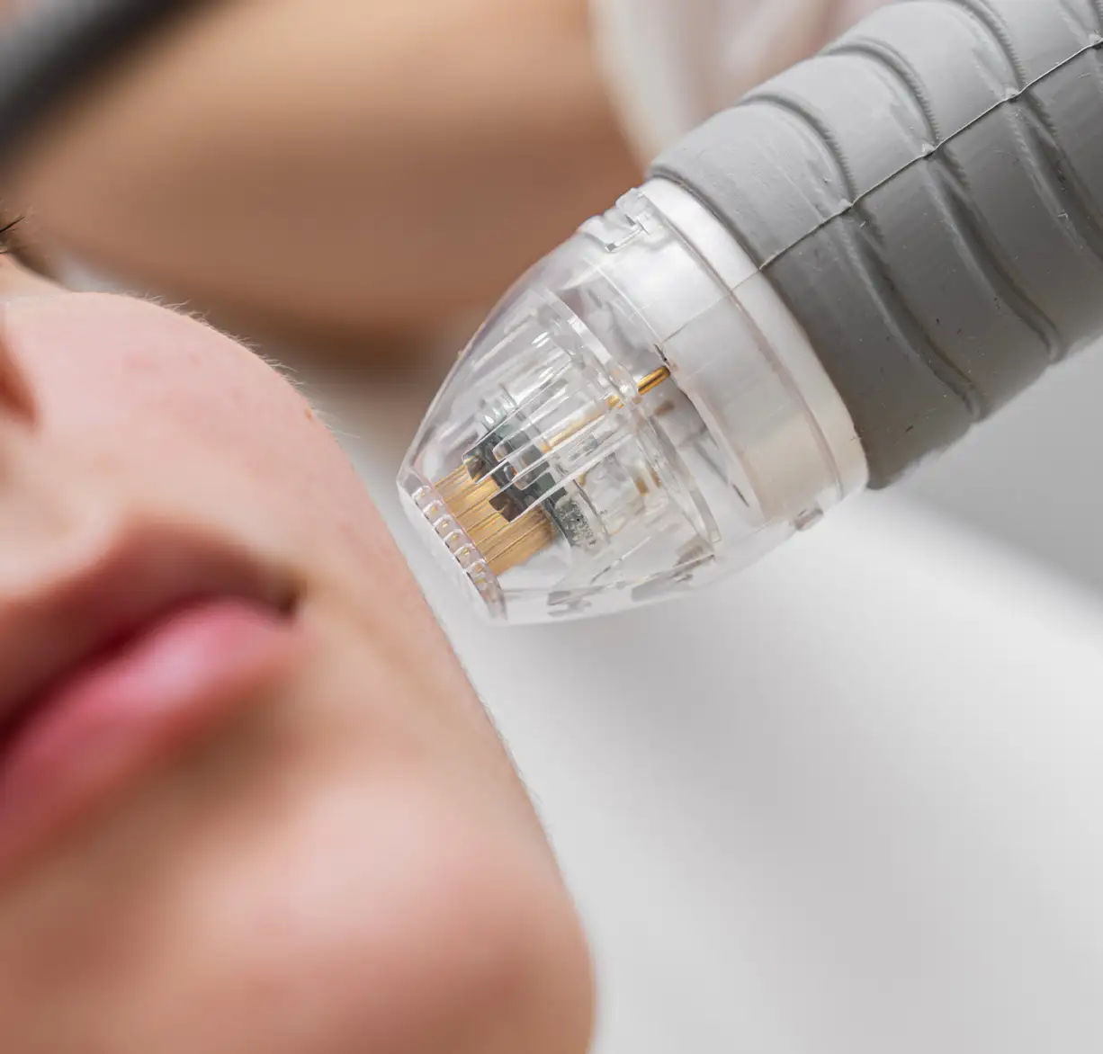 Tecnologias dermatológicas