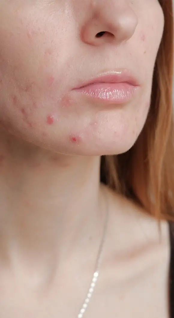 Avaliação dermatológica
