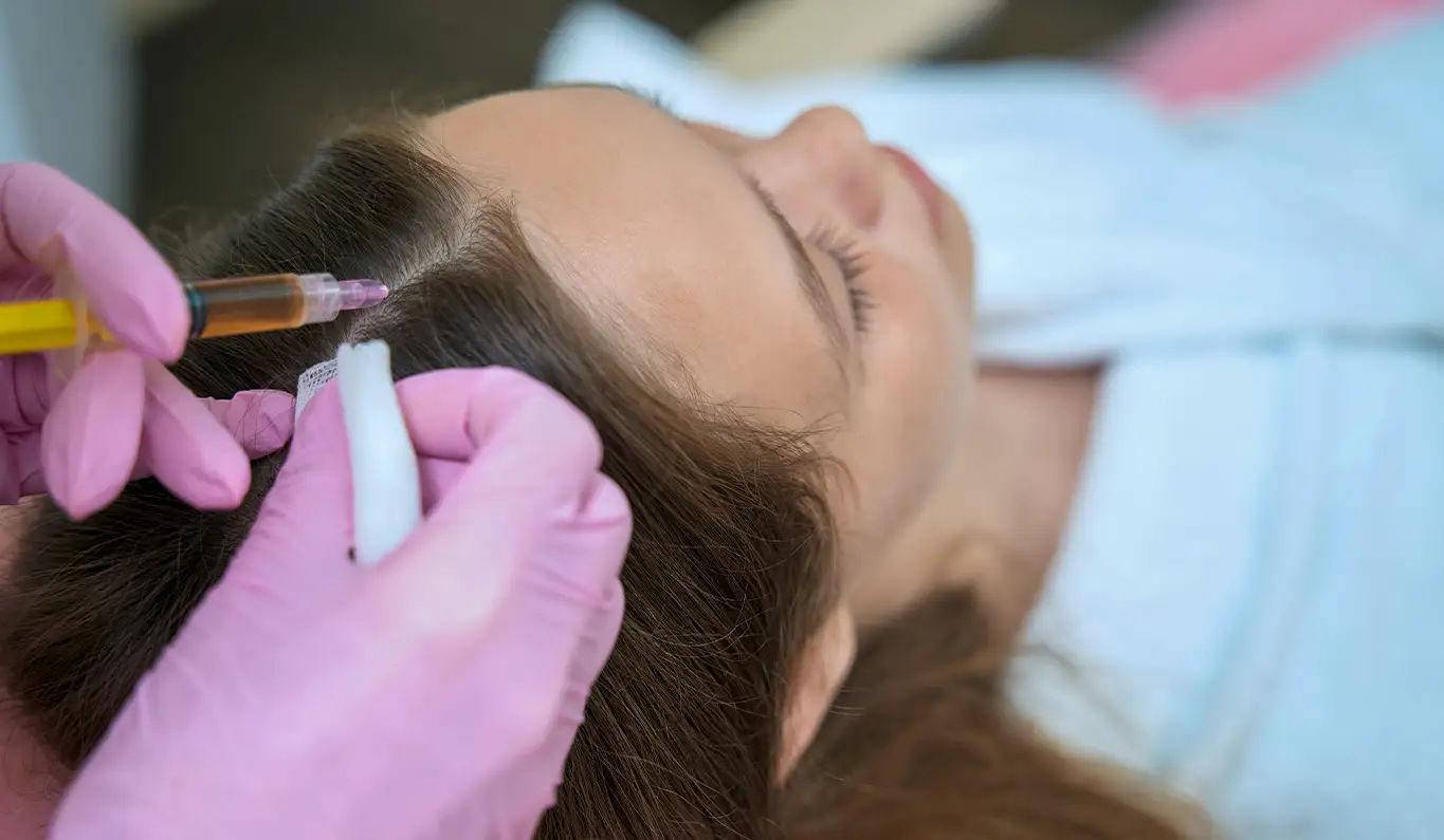 Intradermoterapia capilar